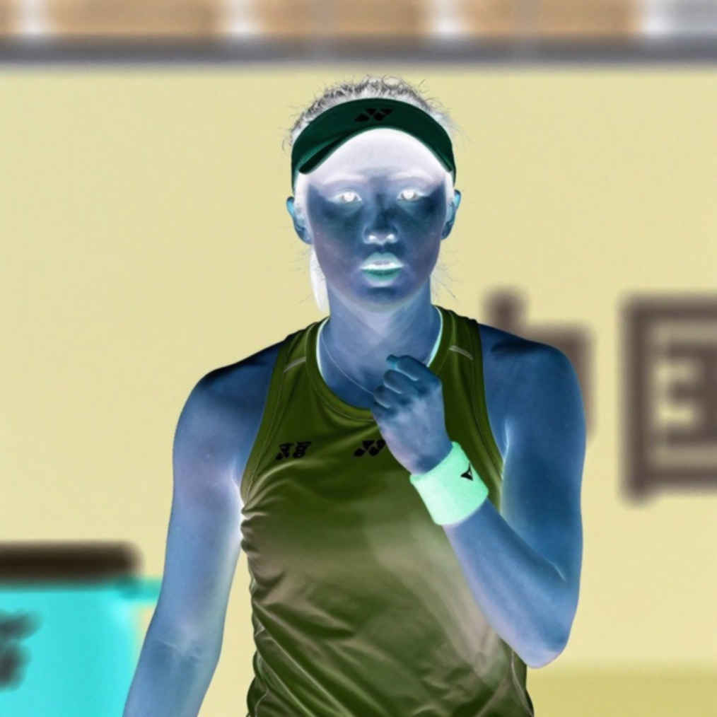 Badminton Transfer Window: When the Injury Data Sheet Speaks Before the Contract